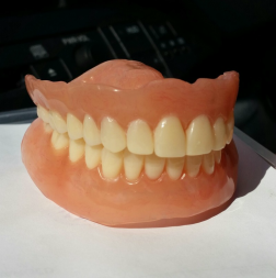 Upper and Lower Full Acrylic Dentures